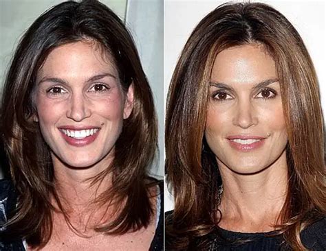 cindy crawford nose|Cindy Crawford Nose Job Plastic Surgery Before and。